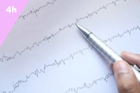 ECG - lecture et interprétation essentiel