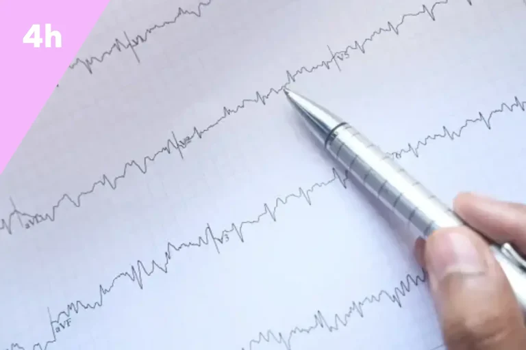 ECG - lecture et interprétation essentiel