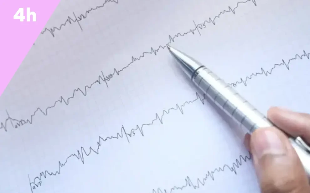 ECG - lecture et interprétation essentiel