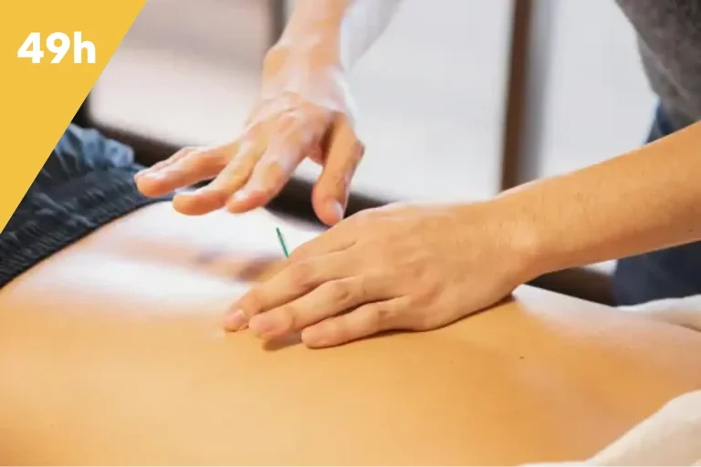 dry needling intégral