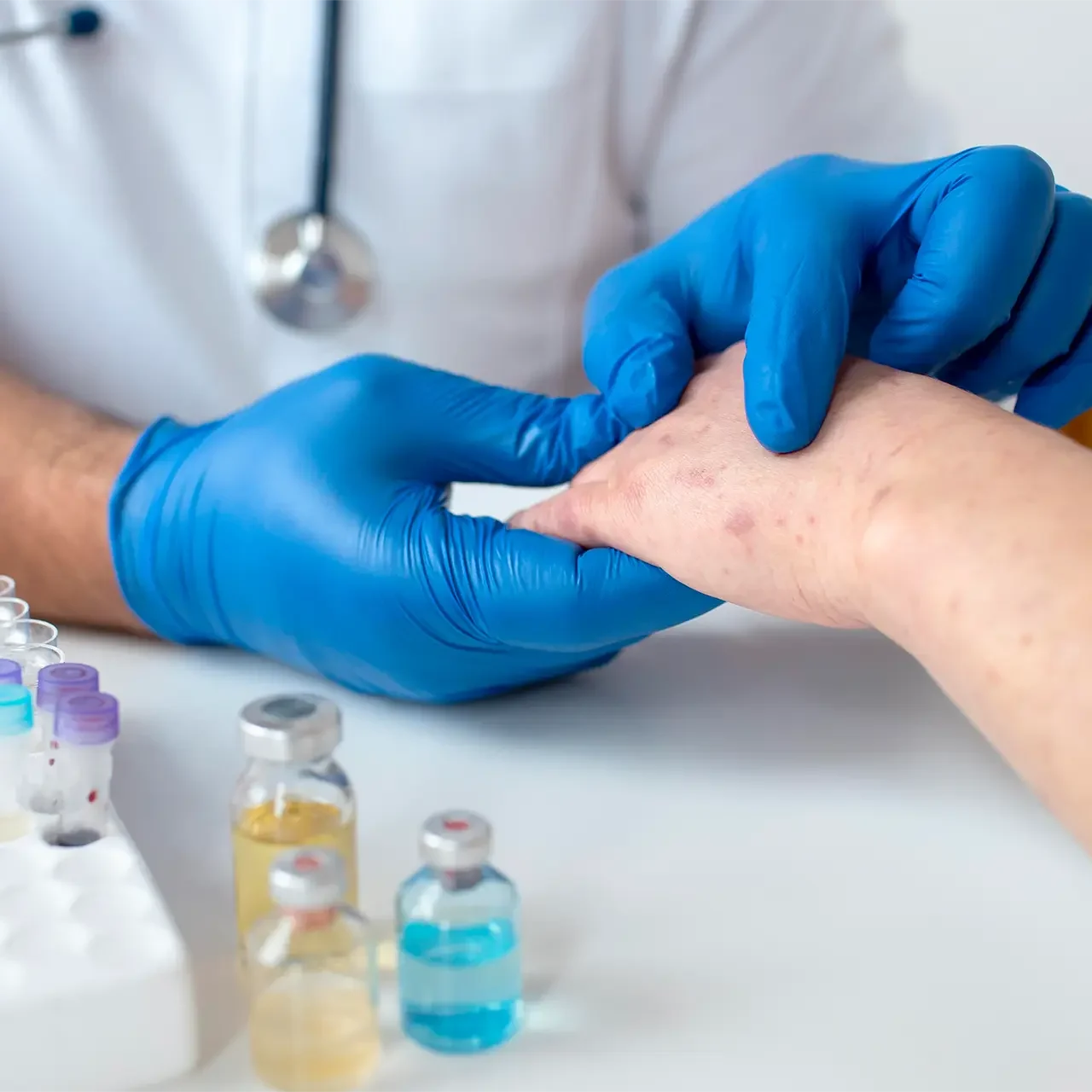 Plaies et processus de cicatrisation distanciel